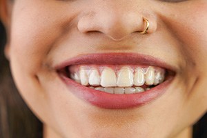 a close-up of a clear aligner