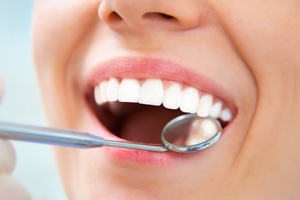 a person opening their mouth for a dental checkup