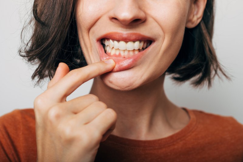 Lady shows off white teeth