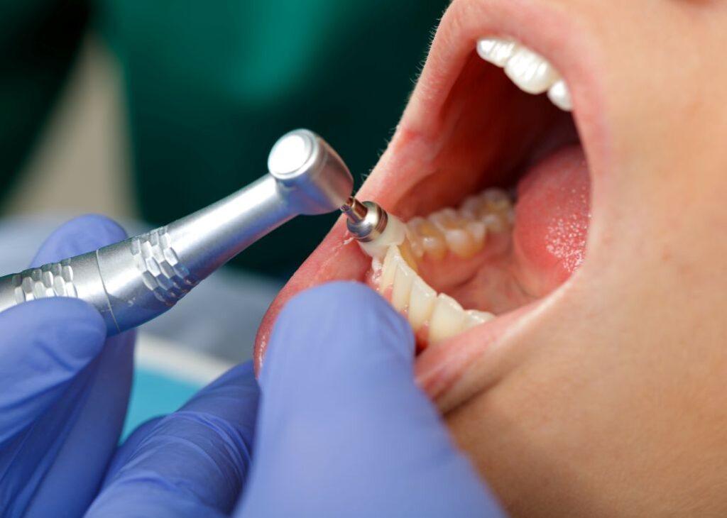 A woman getting a dental cleaning